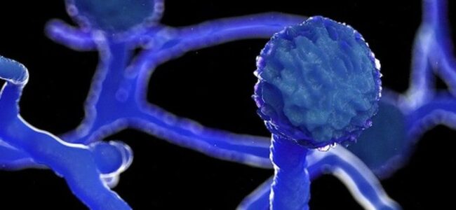 First case of Black Fungus detected at SKIMS: Officials