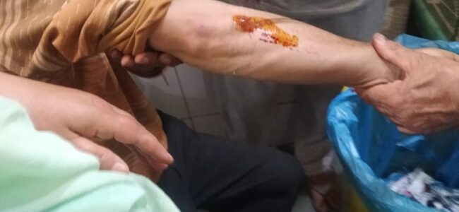 Several injured in mysterious blast at Tral bus stand: Officials