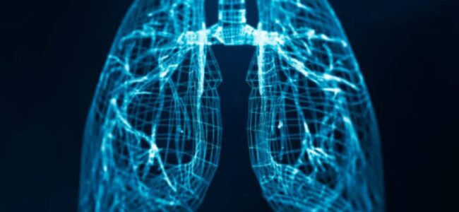Of all lung cancer patients, 40 pc never smoked: BJP MP demands national screening programme