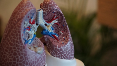 Lung cancer pill cuts risk of death by half: Study