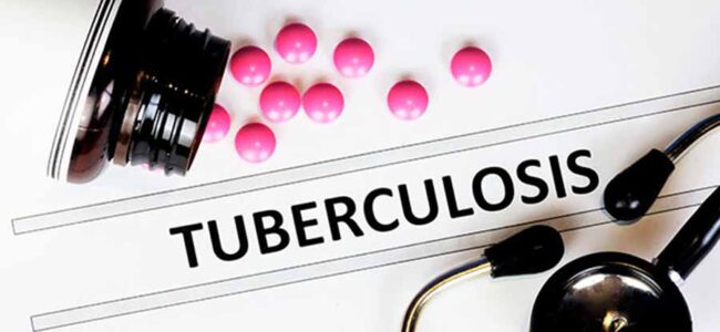 India, world failed to meet WHO End-TB milestone 2020: Lancet Study