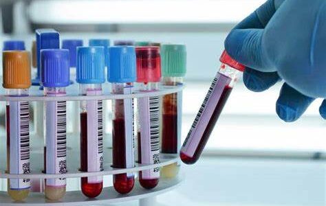 Deaths in Village Budhal, Rajouri not due to any communicable disease of bacteria: Govt