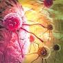 World Cancer Day: Kashmir Records Sharp Rise in Cancer Cases World Cancer Day: Kashmir Records Sharp Rise in Cancer Cases