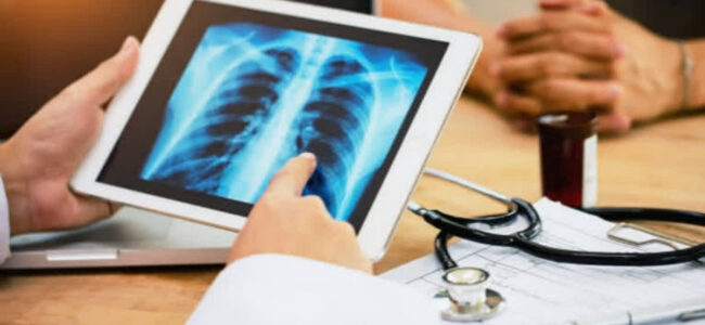 CT scans linked to higher risk of blood cancers in young people: Study CT scans linked to higher risk of blood cancers in young people: Study
