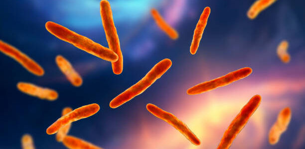 New TB skin test could offer cheaper and easier way to detect the disease