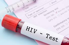 UN says nearly 40 million people had HIV in 2023 UN says nearly 40 million people had HIV in 2023