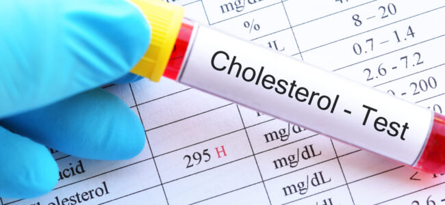 ‘Bad’ cholesterol among new risk factors of dementia: Study ‘Bad’ cholesterol among new risk factors of dementia: Study